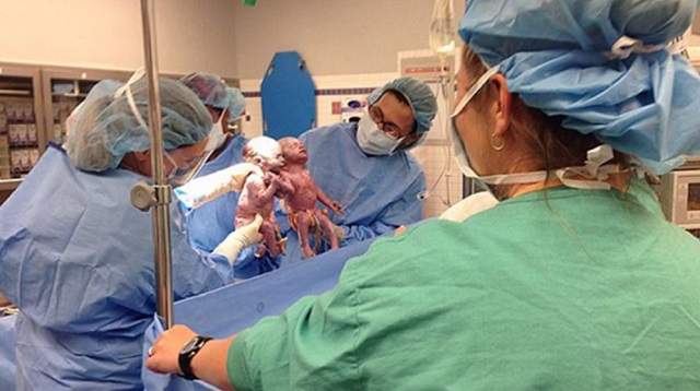 FOTO & VIDEO / S-au născut ţinându-se de mână, iar medicii le-au dat 50% şanse de supravieţuire! Au trecut doi ani şi acum arată aşa