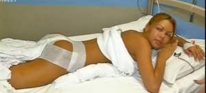 Beyonce de România s-a operat din nou la posterior, dar are dureri groaznice. Cine i-a fost alături