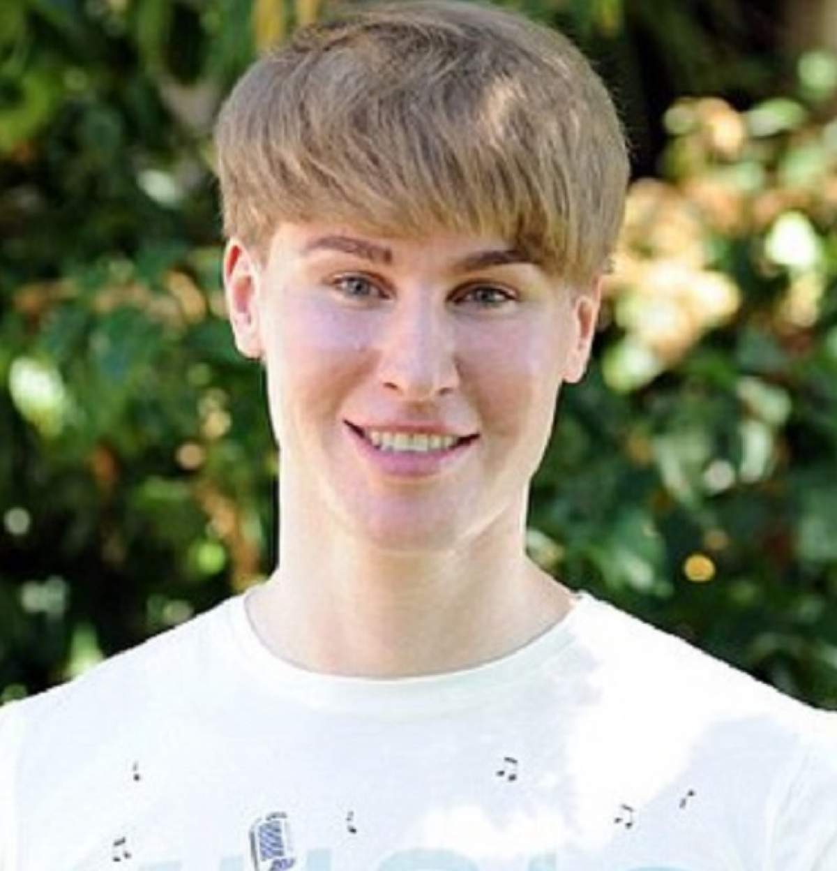 Cauza morţii tânărului care a cheltuit 90.000 de euro ca să arate ca Justin Bieber, făcută publică