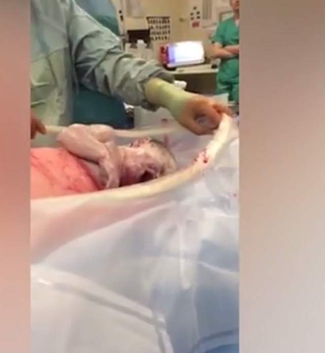 VIDEO / A născut prin CEZARIANĂ NATURALĂ şi a filmat totul! Moment ULUITOR cu venirea pe lume a unui băieţel: "Oh, uită-te la el!"