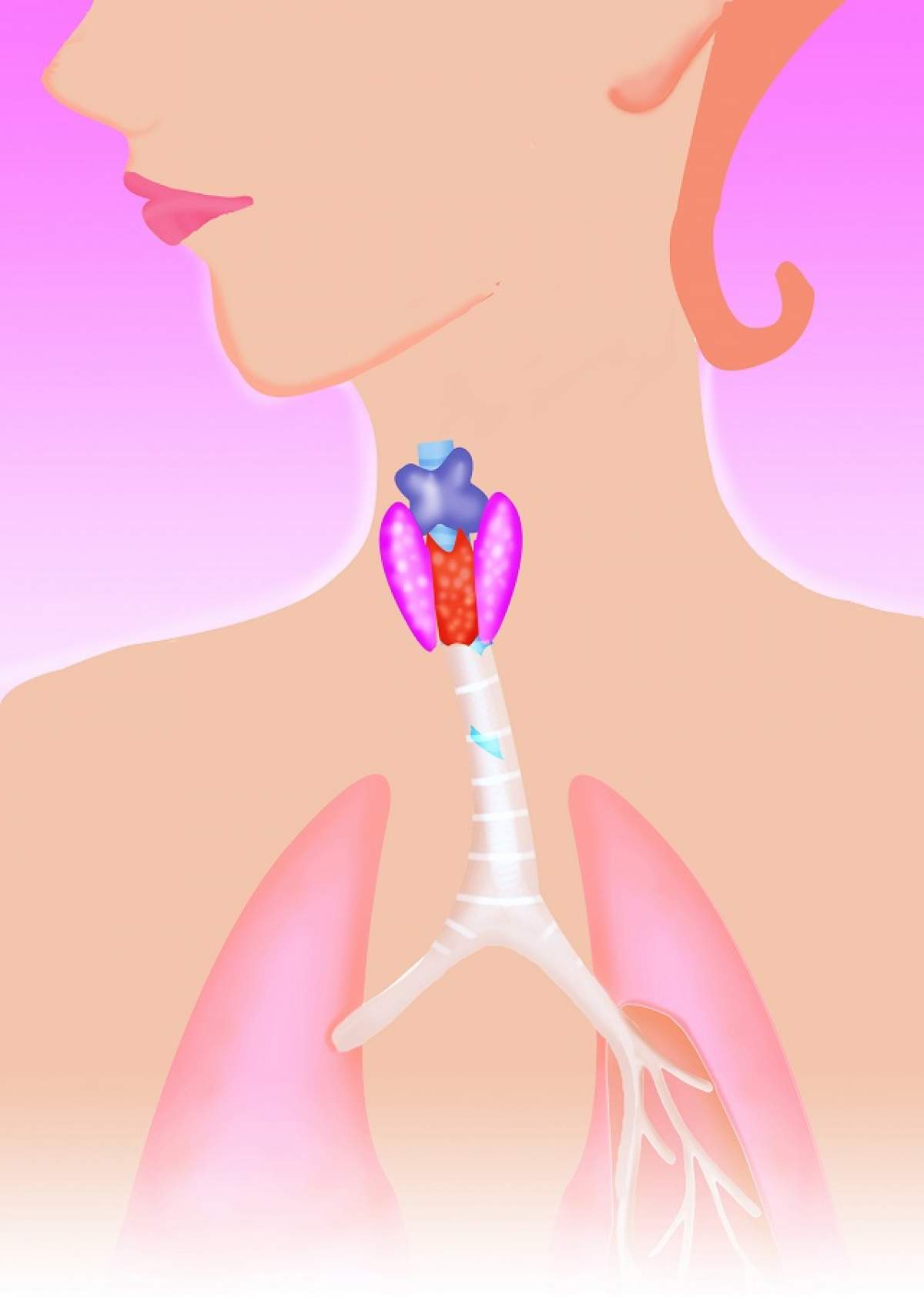 Cancerul tiroidian poate fi tratat! Care sunt cauzele şi simptomele acestei afecţiuni