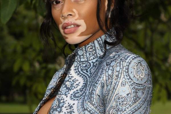 Şi-a învins COMPLEXUL şi a devenit un MODEL! Winnie Harlow, apariţie de SENZAŢIE la un eveniment