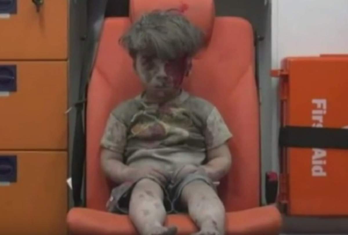 VIDEO / Imaginea care BÂNTUIE internetul! Războiul civil din Siria a făcut un COPIL să arate aşa!