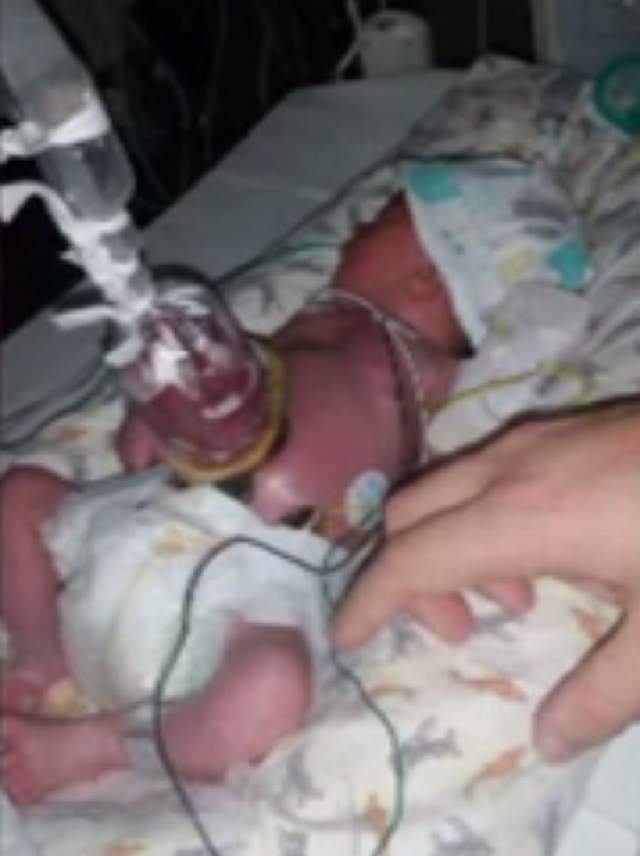 FOTO / I s-a spus că fiul ei se va naşte cu organele în exteriorul corpului, dar a refuzat avortul! Cum arată copilul căruia medicii nu i-au dat nicio şansă