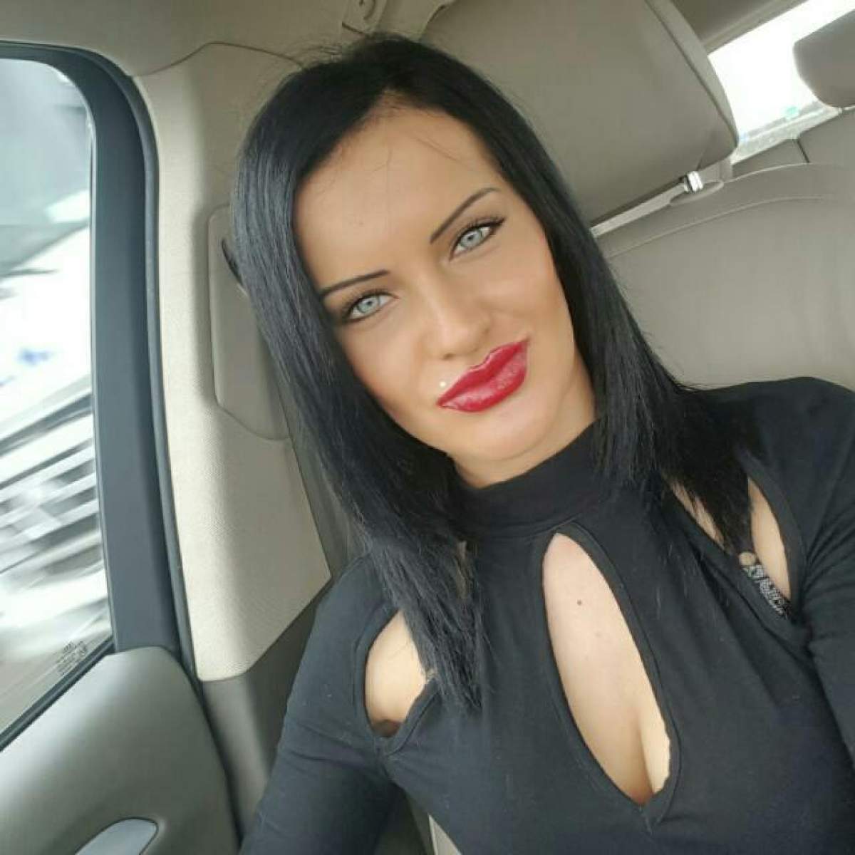 EXCLUSIV / Şi mutilată, şi cu banii luaţi! Răsturnare de situaţie în cazul modelului rămas fără buză după o operaţie estetică