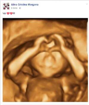 Morgana este însărcinată? A postat o fotografie cu ecografia şi a stârnit controverse