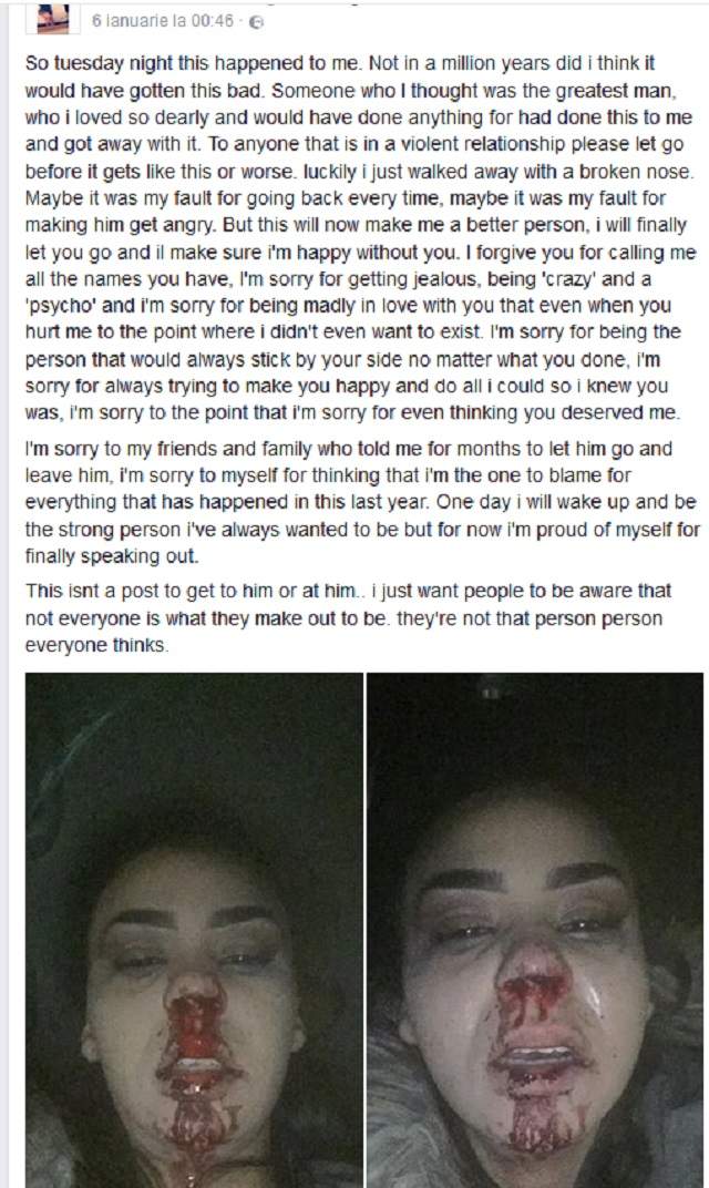FOTO / O tânără a fost mutilată de iubitul ei şi a postat imaginile pe Internet. Zeci de mii de oameni au rămas şocaţi