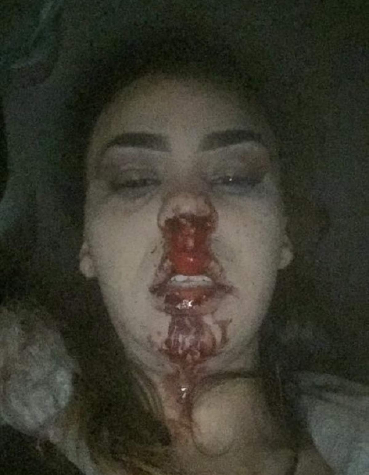 FOTO / O tânără a fost mutilată de iubitul ei şi a postat imaginile pe Internet. Zeci de mii de oameni au rămas şocaţi