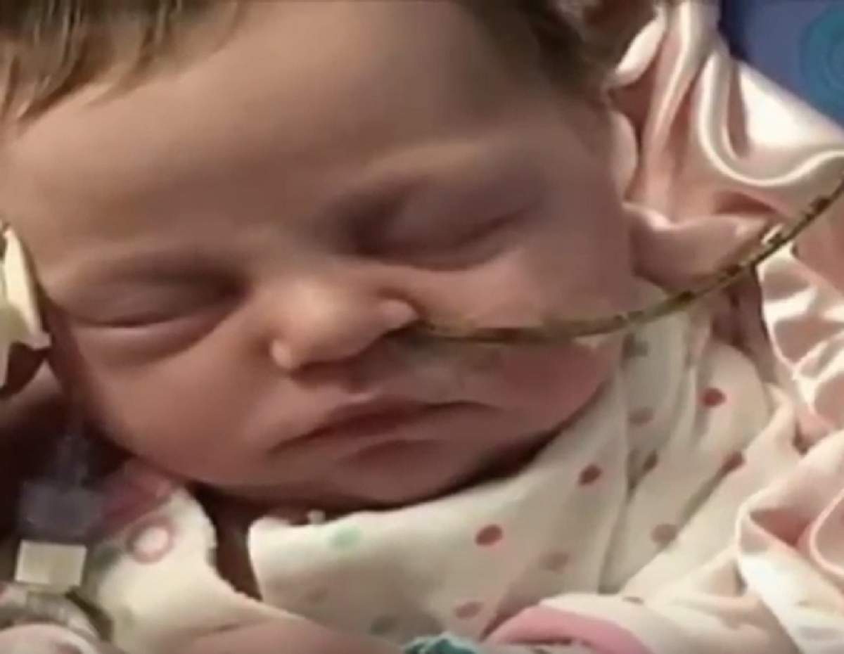 VIDEO / Bebeluș născut cu organele interne în exterior! Imagini șocante surprinse la scurt timp după naștere