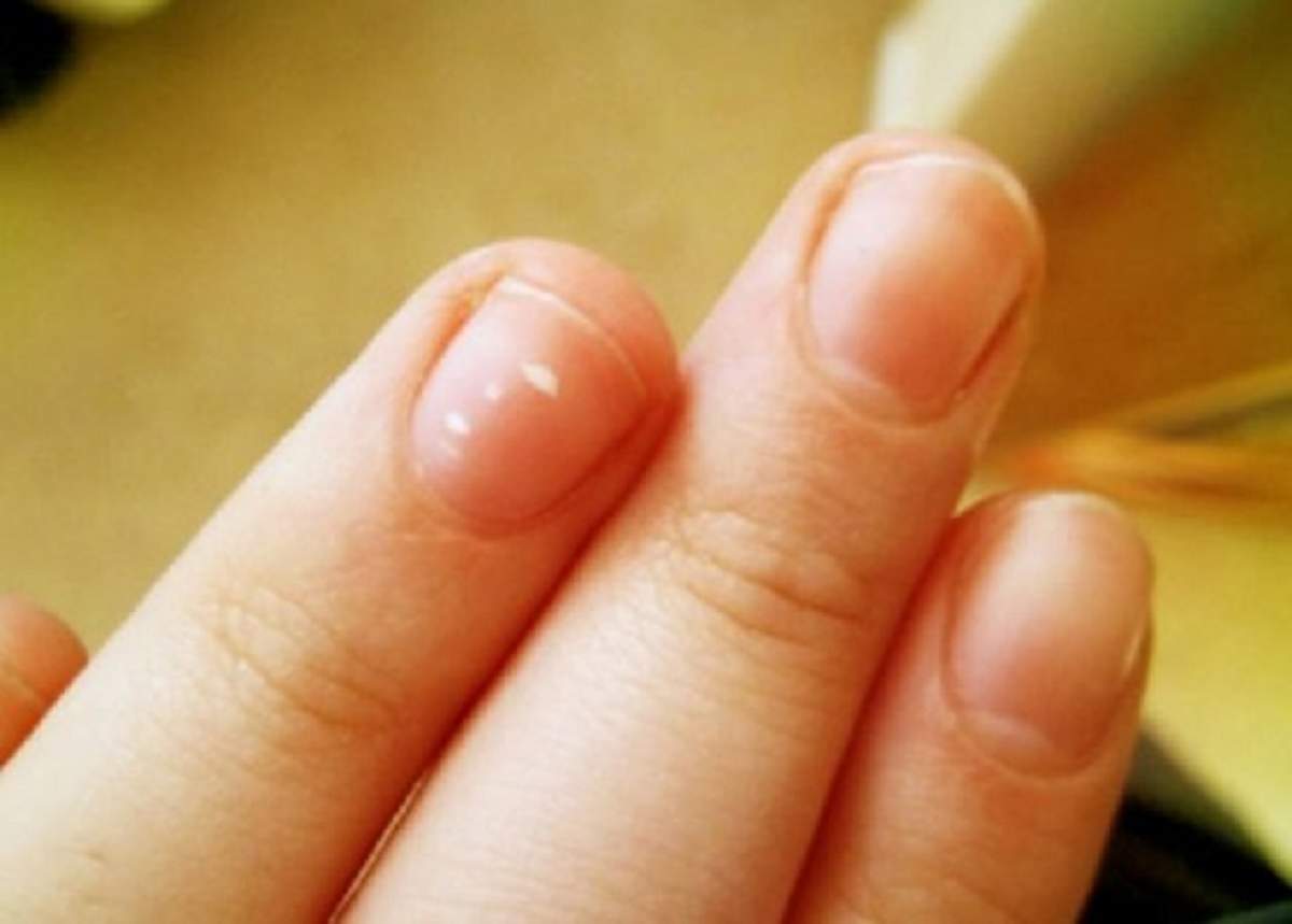 ÎNTREBAREA ZILEI: Cum poți depista bolile de care suferi doar privindu-ți atent unghiile? Poți depista cancerul