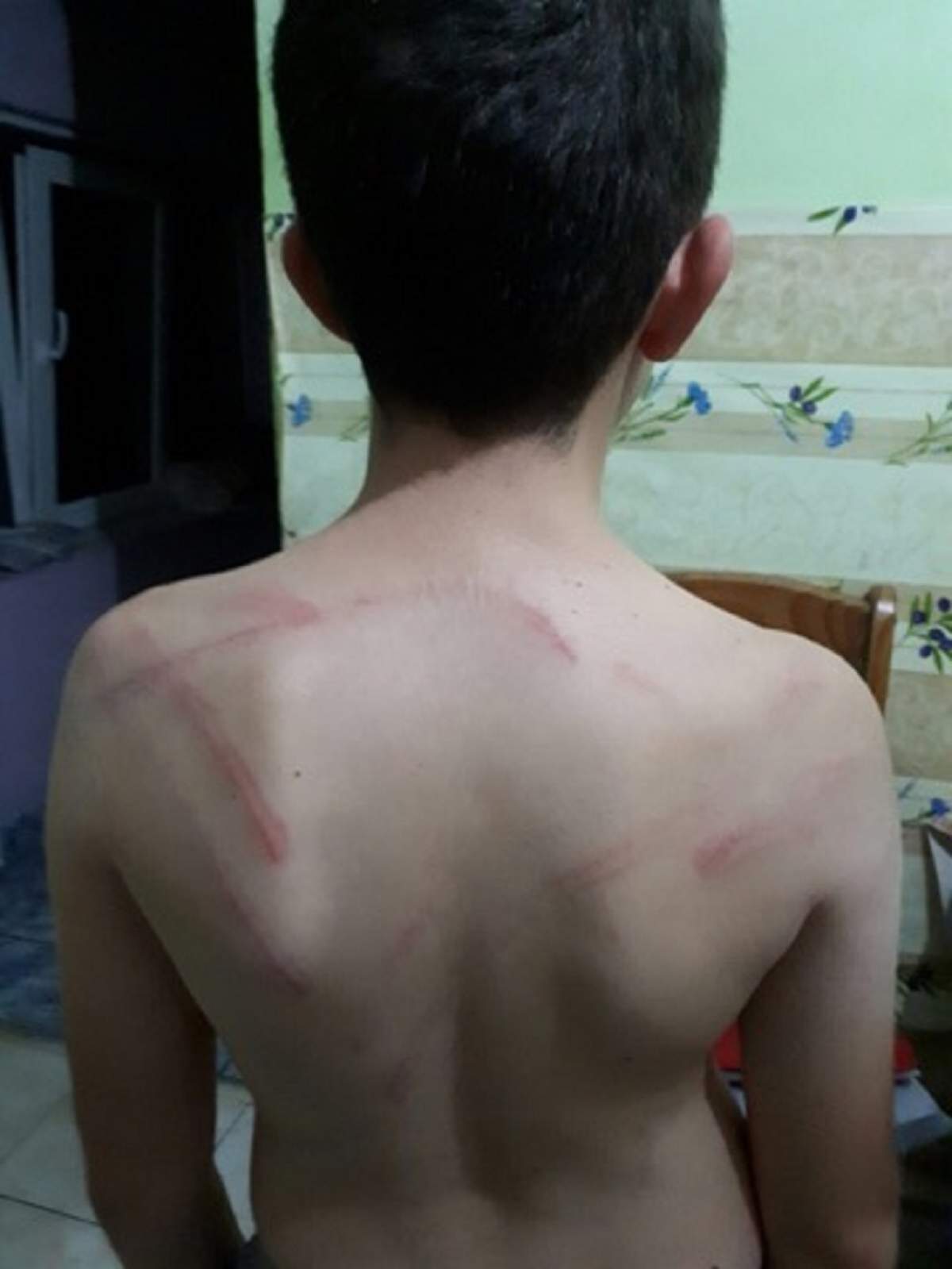 FOTO / Incredibil! Un băiat de 9 ani din Arad a fost bătut crunt de tatăl său! Imaginile sunt şocante
