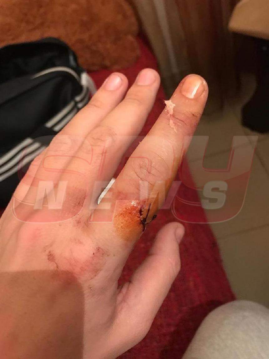 FOTO / Imagini necenzurate! Botezatu și-a tăiat degetul, în bucătărie