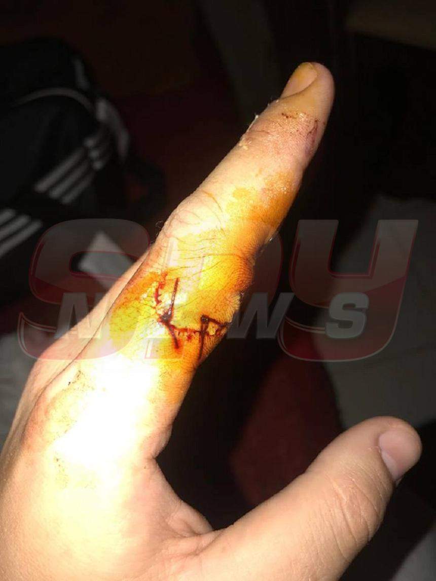 FOTO / Imagini necenzurate! Botezatu și-a tăiat degetul, în bucătărie