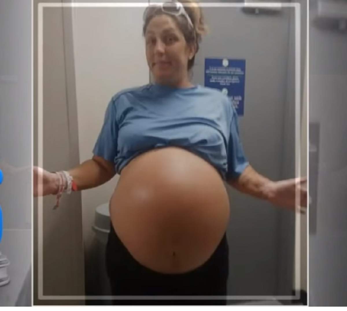 VIDEO / A aflat că este însărcinată, dar burta nu se mai oprea din crescut. În sala de operație, medicii au încremenit