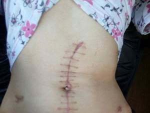 FOTO / O femeie, mutilată pe tot corpul de proxeneţii care o forţau să se prostitueze! Rănile teribile i-au şocat pe medici