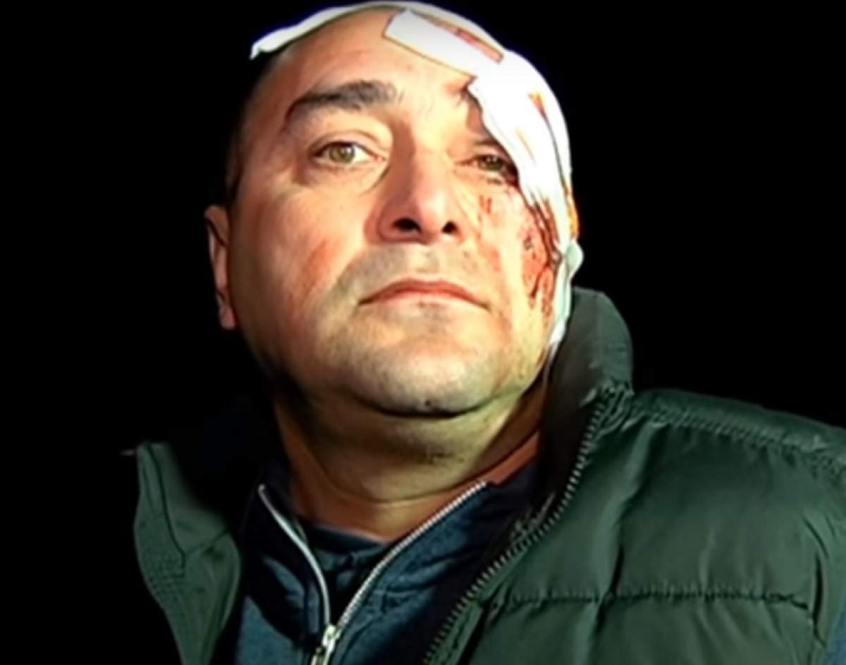 VIDEO / Un bărbat din Neamţ, plin de sânge şi nevinovat! A lovit o căruţă nesemnalizată şi a luat o bătaie soră cu moartea