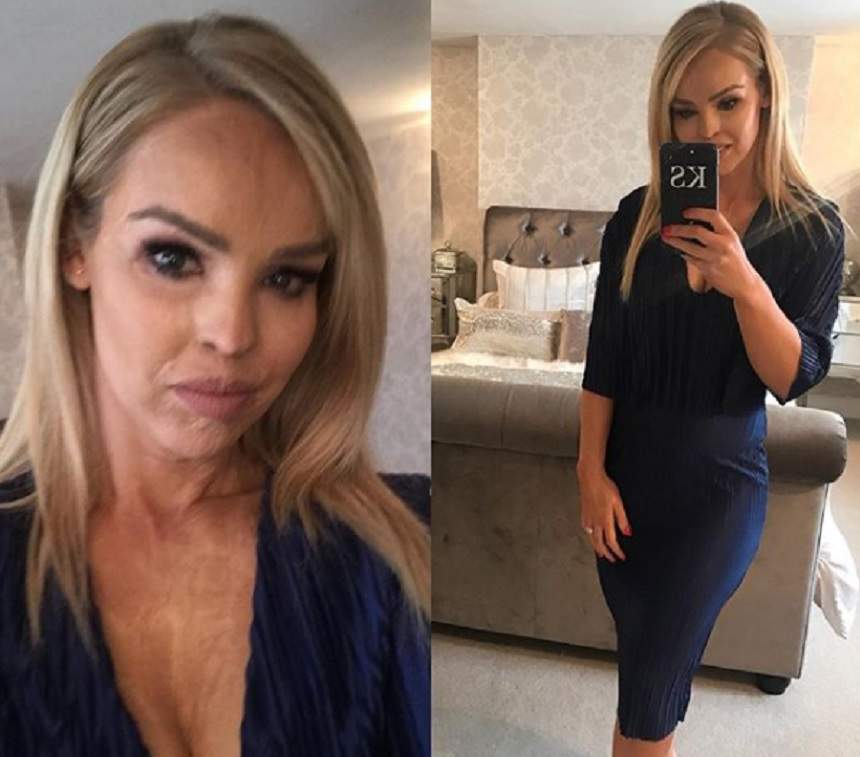 FOTO / Katie Piper, tânăra mutilată cu acid sulfuric, a născut! Prima imagine cu ea și bebelușul