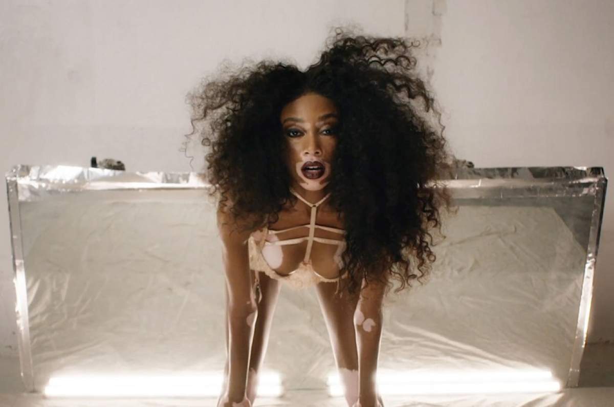 FOTO / Modelul cu pielea în două culori, cu fundul la vedere! Winnie Harlow a pozat provocator în cearşaf