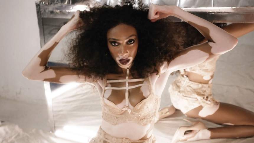 FOTO / Modelul cu pielea în două culori, cu fundul la vedere! Winnie Harlow a pozat provocator în cearşaf