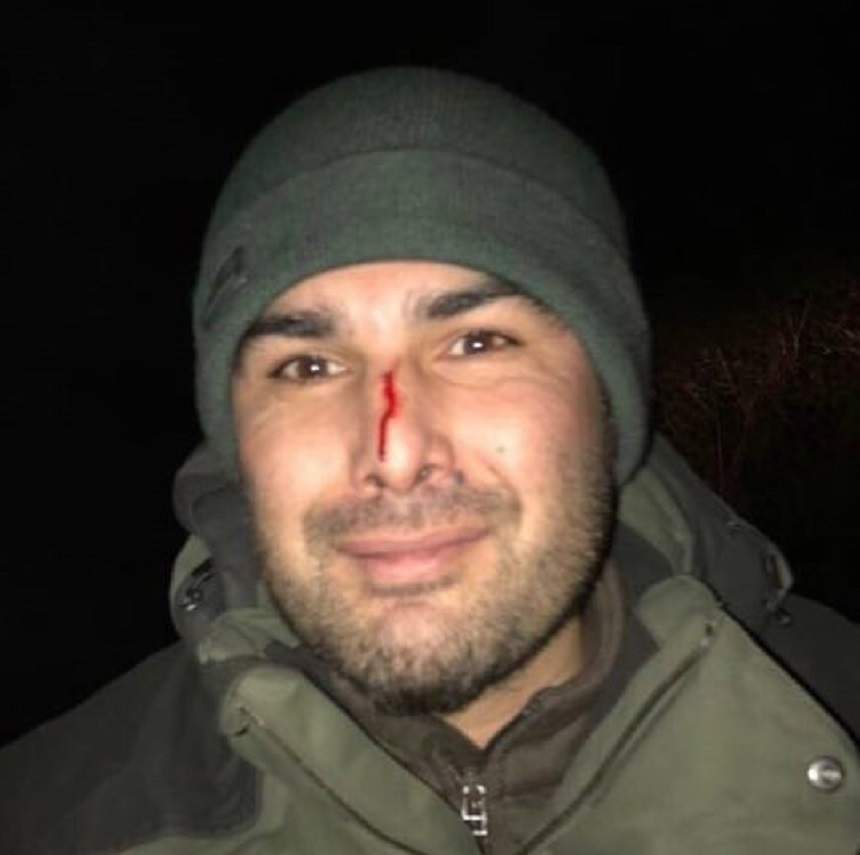 FOTO / Adrian Mutu, implicat într-un teribil accident. Ce a păţit fostul fotbalist