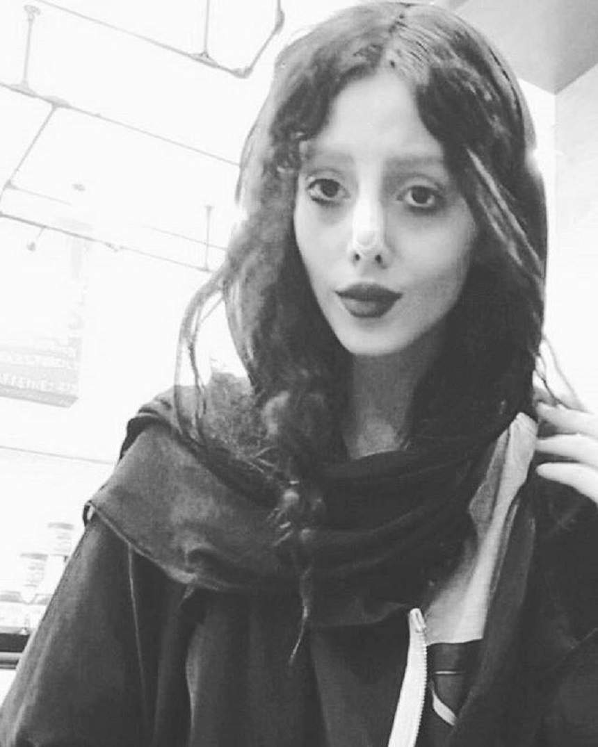 "Nu am 50 de operaţii estetice". Sahar Tabar, tânăra care vrea să arate ca Angelina Joilie, face dezvăluiri uimitoare