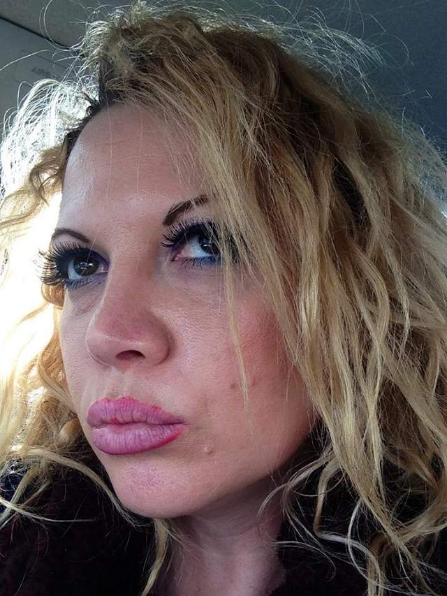 FOTO / Acneea le dă mari bătăi de cap! Ele sunt vedetele care se luptă cu imperfecțiunile tenului