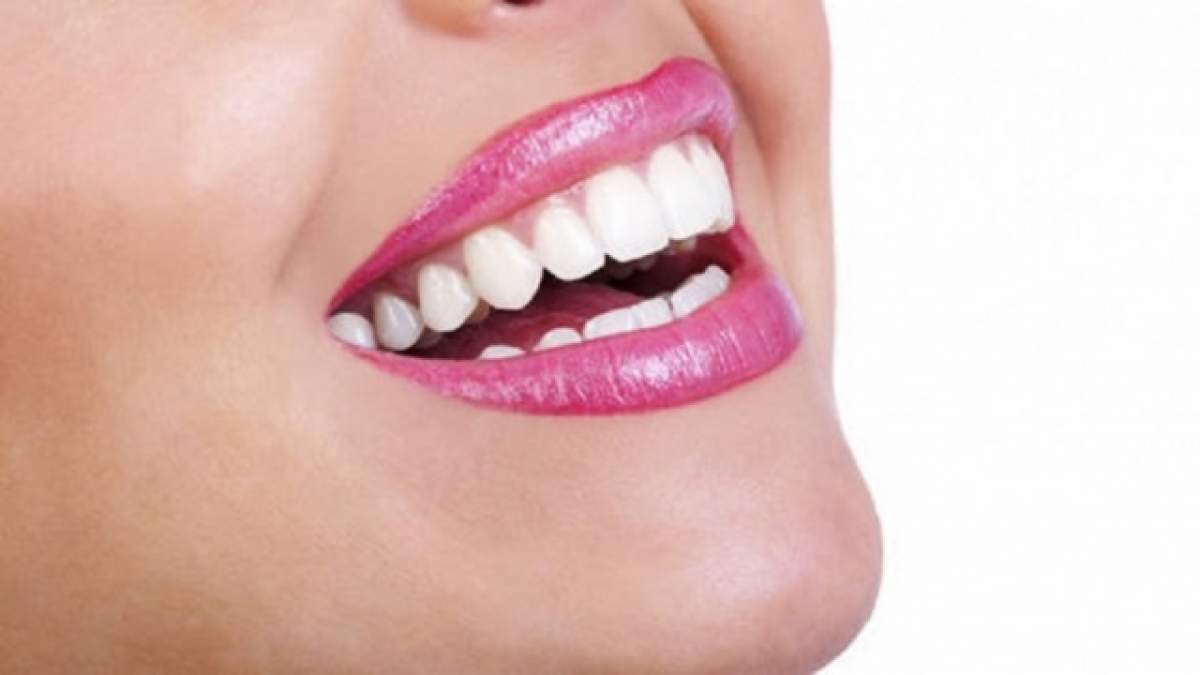 Trei metode să-ți albești dinții acasă doar într-o singură zi!