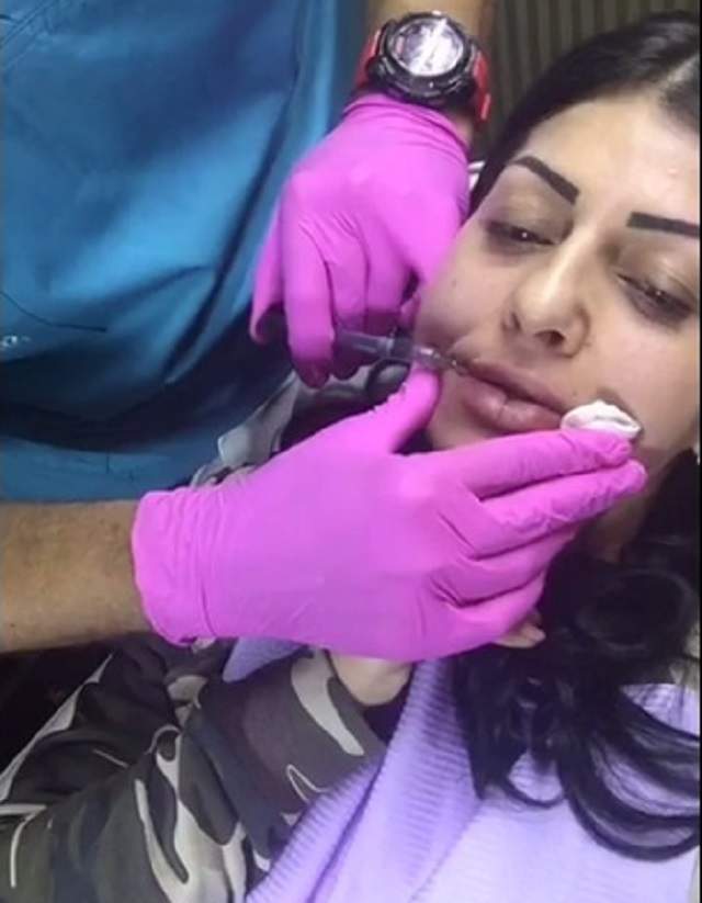 VIDEO / O vedetă de la noi s-a filmat în timp ce îşi injectează buzele! Cum arată la sfârşitul intervenţiei