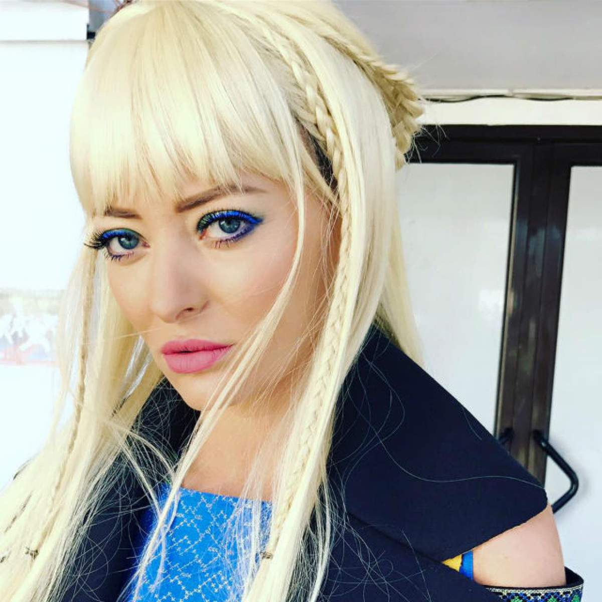 Delia, accidentată înainte de spectacolele de la Sala Palatului! Vedeta le-a arătat tuturor rana pe care a căpătat-o