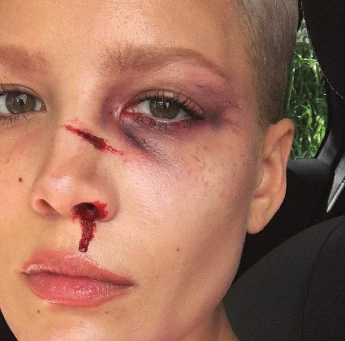 FOTO / Cântăreaţa Halsey, vânătă şi plină de sânge! Fanii au fost şocaţi: "Ce ţi s-a întâmplat?"