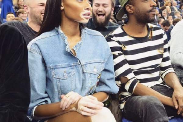 FOTO / O mai ţii minte pe Winnie Harlow, fotomodelul cu pielea în două culori? Boala i s-a extins