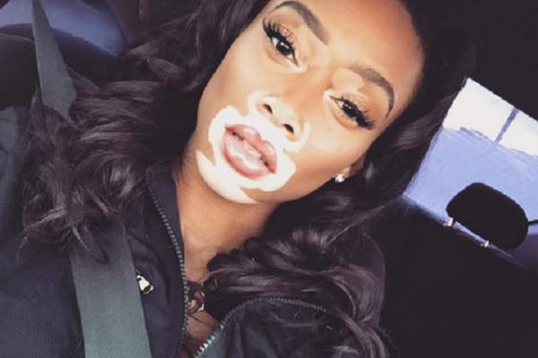 FOTO / Cele mai sexy poze cu Winnie Harlow, fotomodelul cu pielea în două culori! S-a filmat aproape goală, în pat