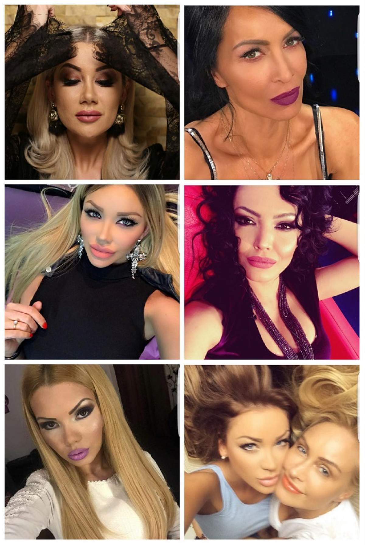 FOTO / Ele sunt vedetele dependente de operațiile estetice! Ajung des pe mâna esteticianului