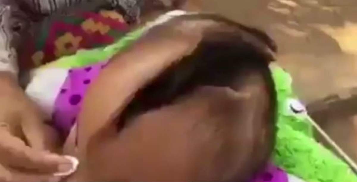 VIDEO / ŞOCANT! Un copil are o crăpătură de peste 10 CENTIMETRI în cap şi continuă să crească! Mărturiile medicilor sunt cutremurătoare