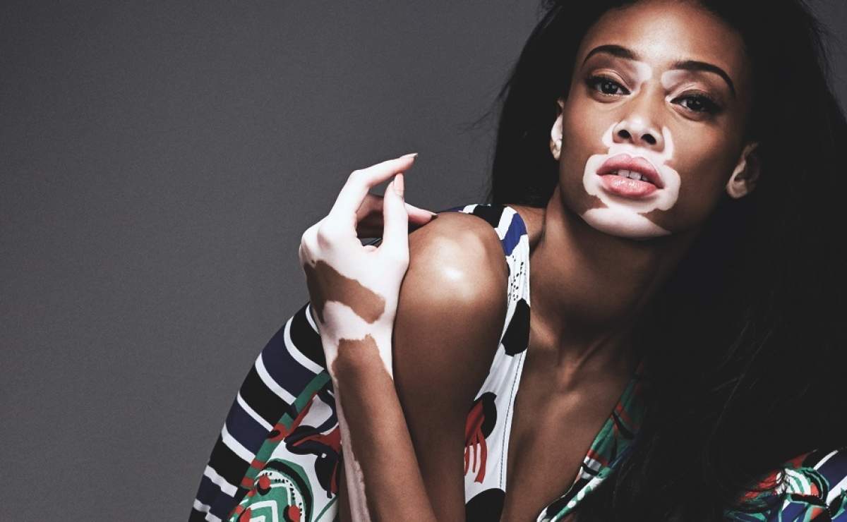 FOTO / Modelul cu pielea în două culori, în brațele unui celebru designer! Winnie Harlow poartă o ținută provocatoare