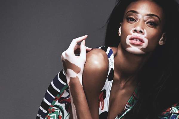 FOTO / Modelul cu pielea în două culori, în brațele unui celebru designer! Winnie Harlow poartă o ținută provocatoare