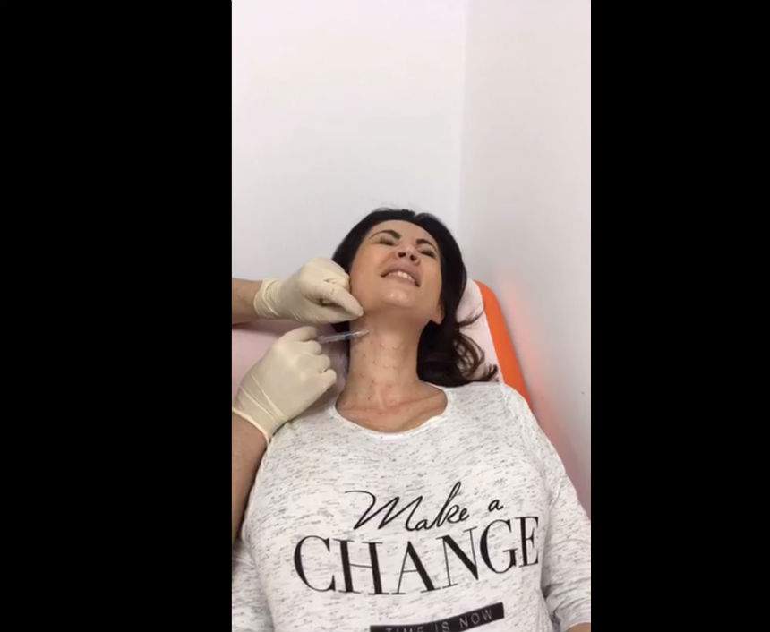 VIDEO & FOTO / Nicoleta Luciu, filmată în timp ce i se făceau injecţii în gât: "Fac orice pentru tinereţe!"