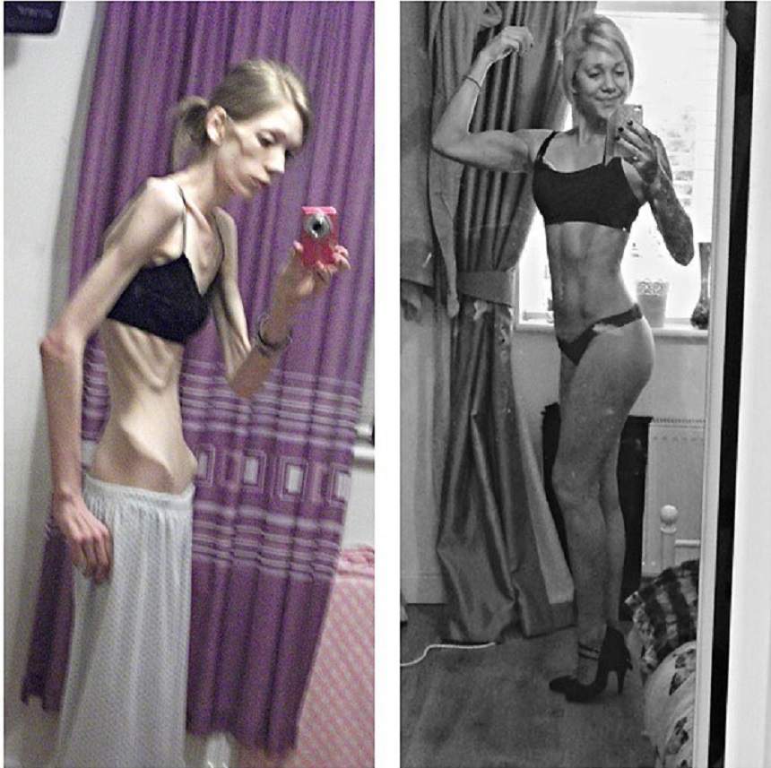 FOTO / Transformarea spectaculoasă a unei tinere anorexice! Cântărea 25 de kilograme, dar acum e campioană la fitness