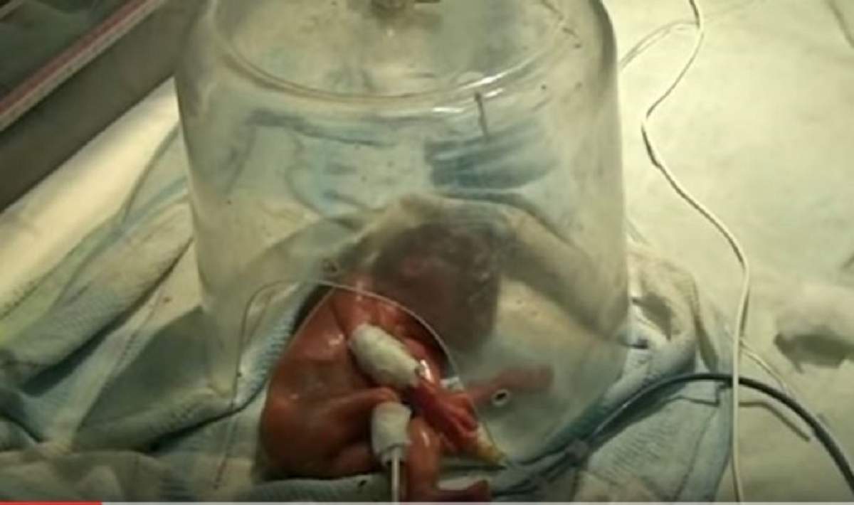 VIDEO / TERIFIANT! Un bebeluș născut prematur a fost declarat mort, dar rudele l-au găsit în viață înainte să fie incinerat