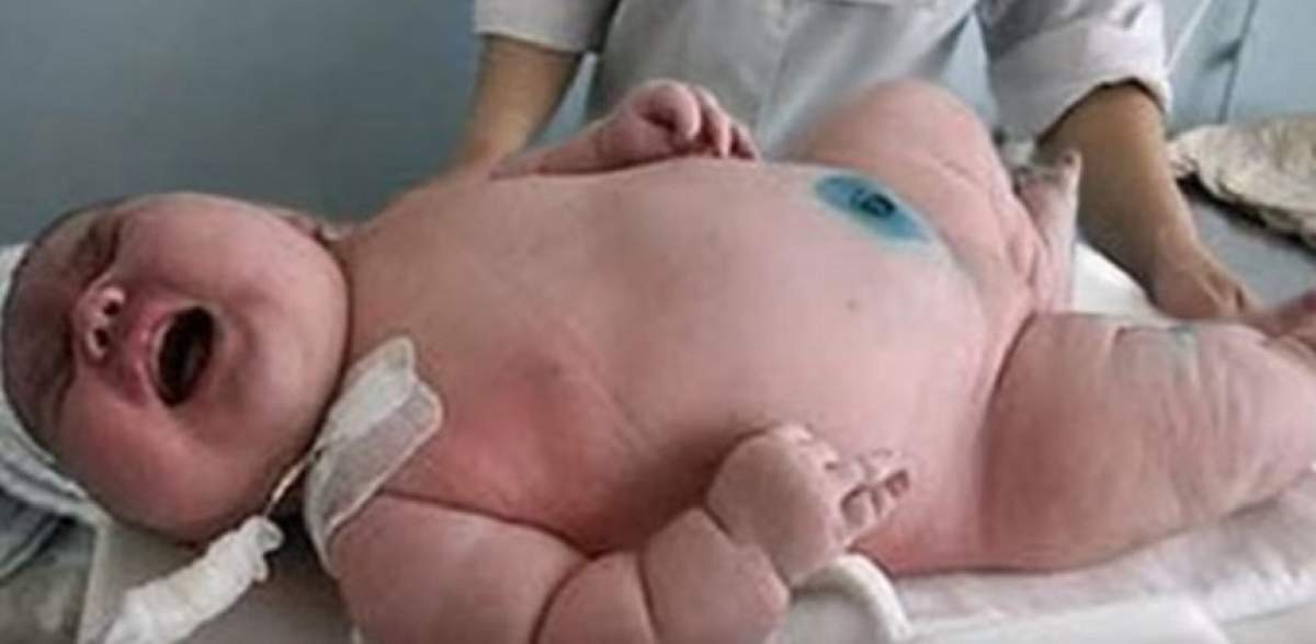 FOTO / O mămică a născut un băiețel de 7,3 kilograme! Cum arată bebelușul uriaș
