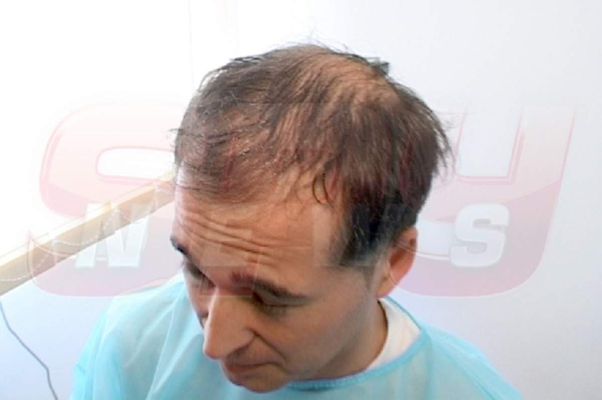 FOTO / Dinu Maxer, frizură tinerească la trei ani de la implantul de păr! Cu ce podoabă capilară se laudă acum artistul