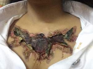 VIDEO / O fată și-a îndepărtat tatuajul de pe piept, iar ce a rămas după este șocant
