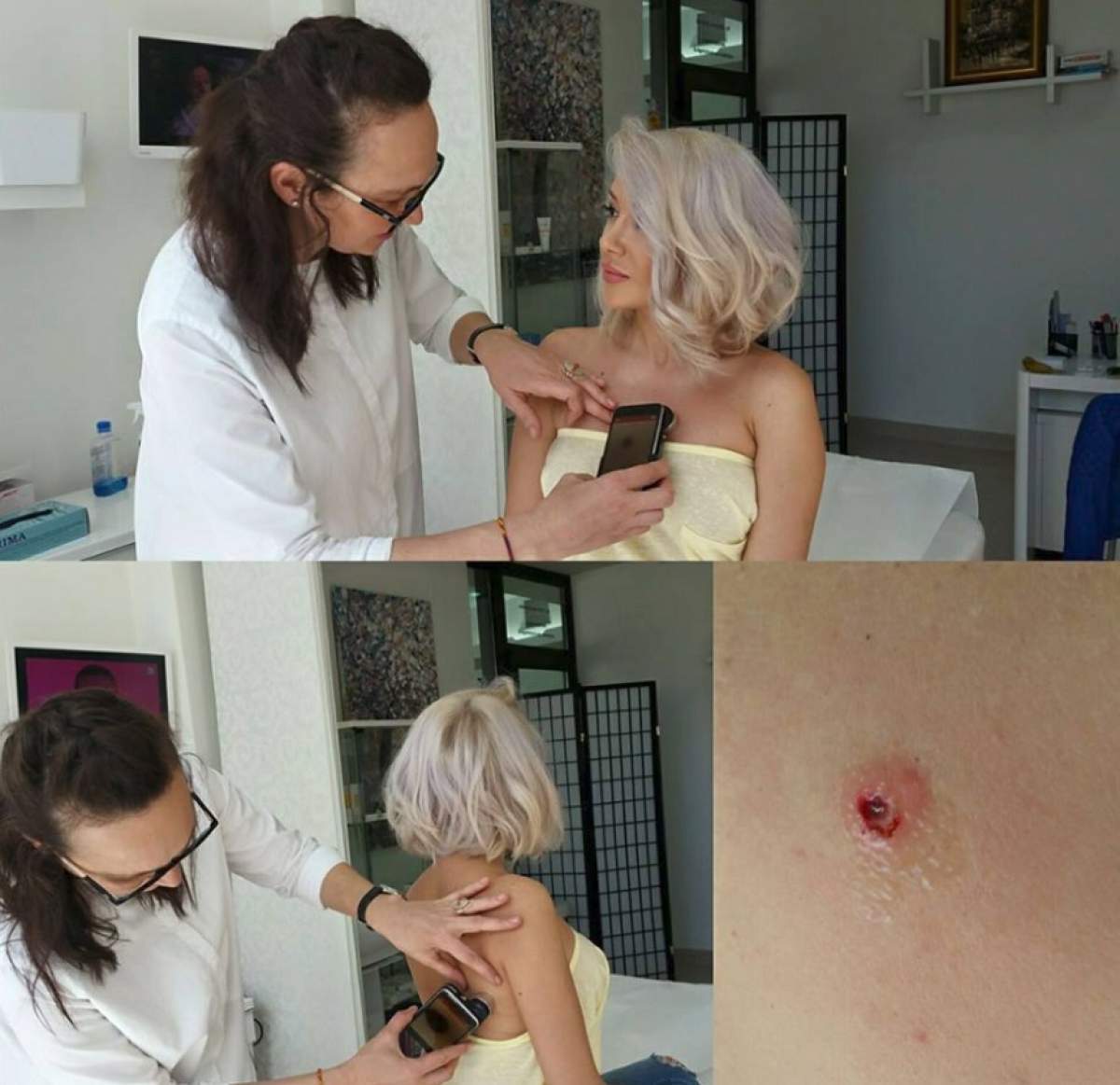 FOTO / Raluca de la "Bambi" a ajuns astăzi la medic: "Aluniţele pot cauza probleme grave: cancerul de piele"