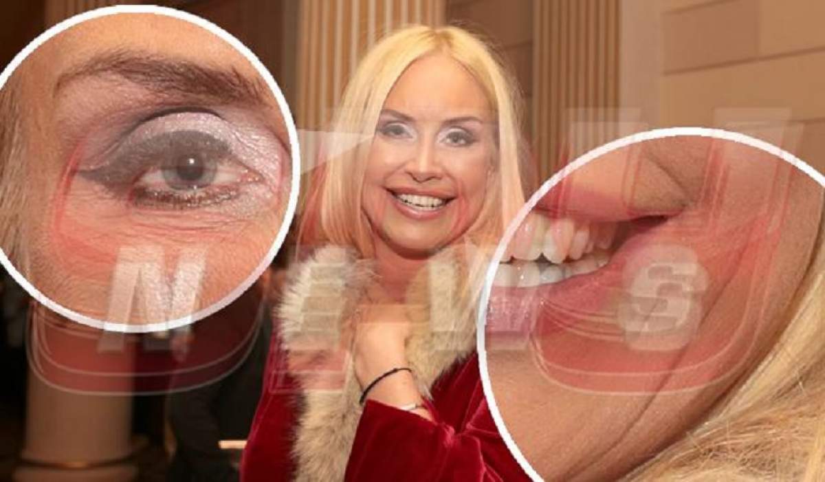 FOTO / "Bunica" Vica a dat fuga la estetician! S-a filmat în timp ce i se injectau substanţe-minune în faţa plină de riduri