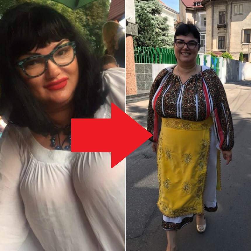 FOTO / Ozana Barabancea, mândră la 5 zile după operaţia de micşorare a stomacului! Se văd deja schimbări!