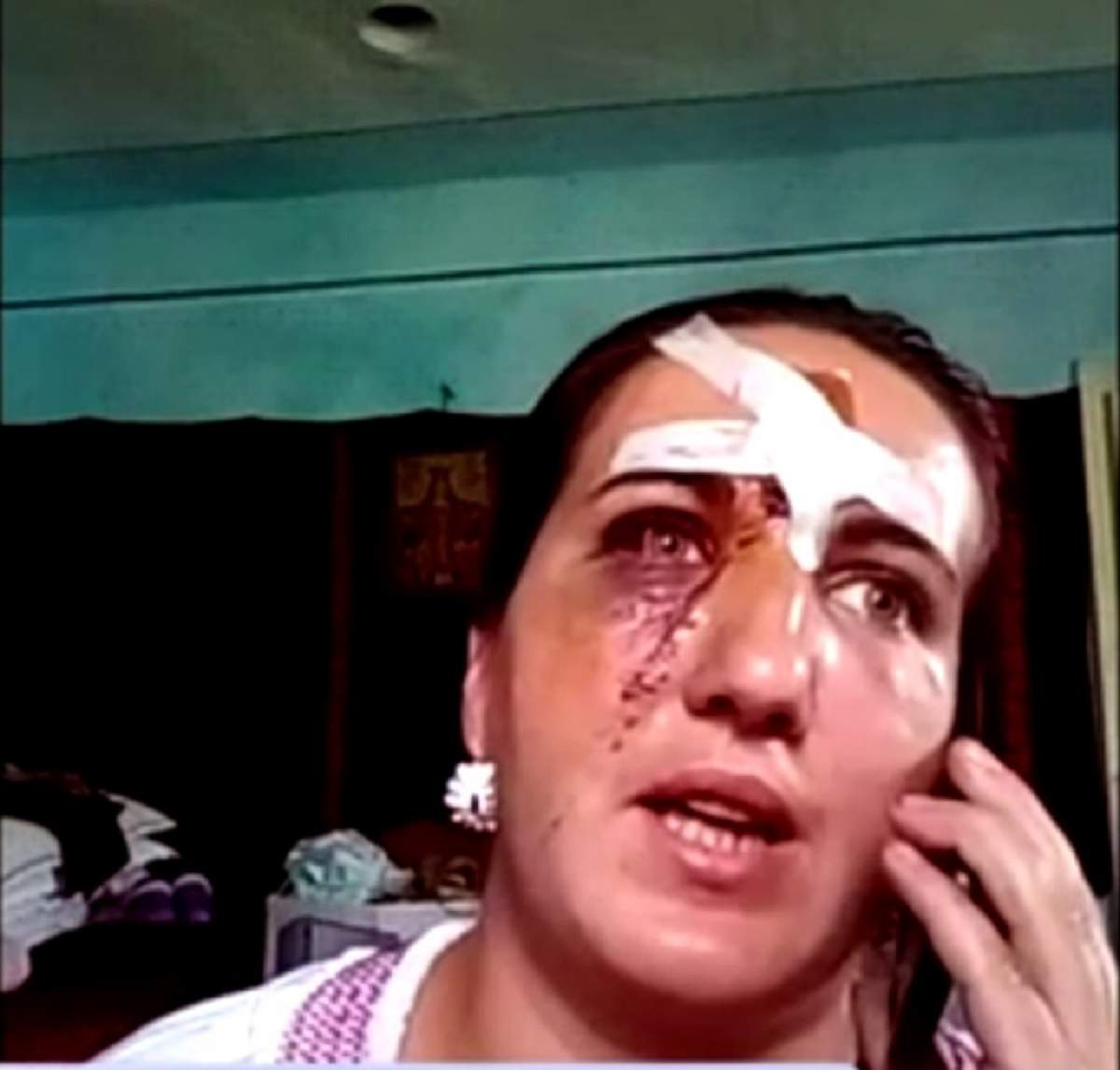 Bătută cu sălbăticie chiar în propria curte! O mămică de 29 de ani a fost mutilată lângă copilul de 3 ani