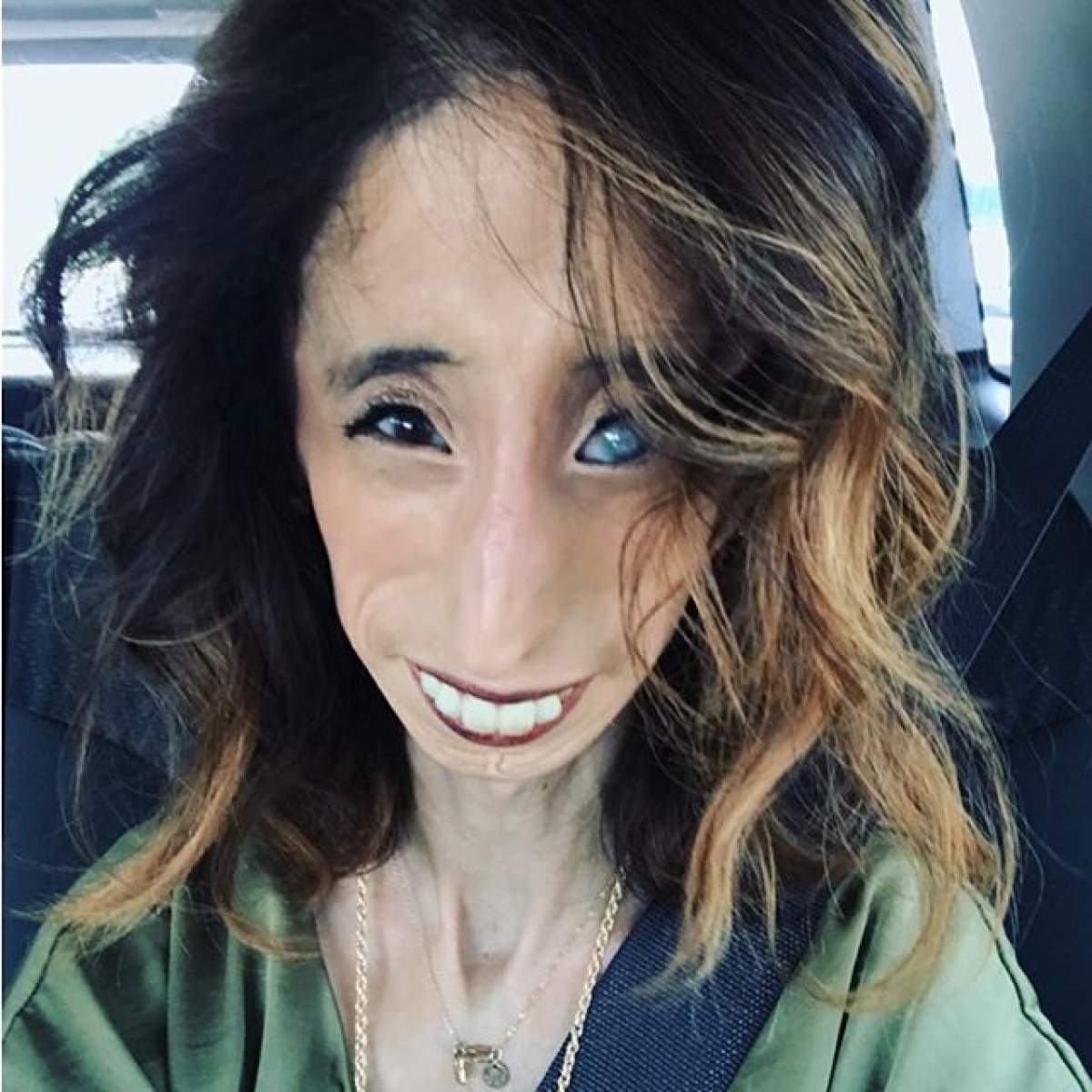 FOTO / Lizzie Velasquez, "Cea mai urâtă femeie din lume", s-a pozat în costum de baie. Cum arată