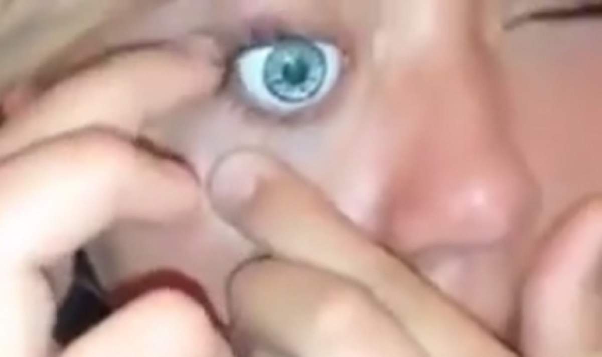 VIDEO / Și-a înlocuit ochiul cu unul de păpușă! Momentele horror prin care a trecut o fetiță