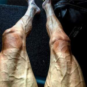 FOTO / Imagini şocante cu un biciclist în timpul turului Franţei: "După şase stagii, cred că picioarele mele sunt puţin obosite"