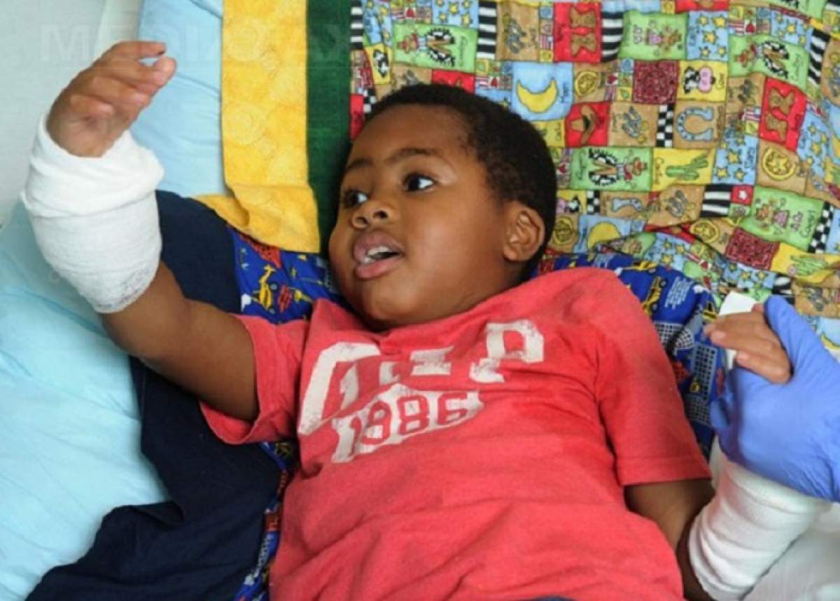 Povestea IMPRESIONANTĂ a lui Zion, băieţelul rămas fără mâini și picioare la vârsta de 2 ani. E incredibil ce poate face acum, la doi ani de la o operaţie unică în lume